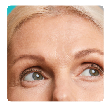 Reduce líneas finas de expresión y arrugas